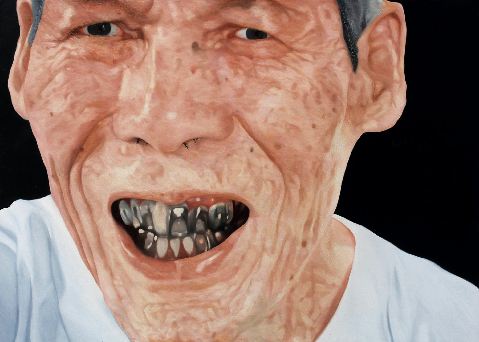 左侧牙有点脱落,半个脸都疼,应该怎么办,疼的睡